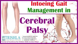 Intoeing Gait Management in Cerebral Palsy  Trishla Foundation [upl. by Ahel]