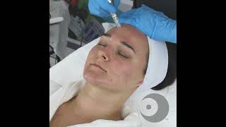 NANO Infusion  Oxygen Infusion with Skin Scrubber Technique Video [upl. by Stedt530]