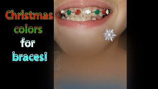 Designer Christmas colors for braces 🦷 Vlog [upl. by Barton179]