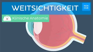 Weitsichtigkeit Ursachen Symptome Behandlung  Kenhub [upl. by Ardnatal577]