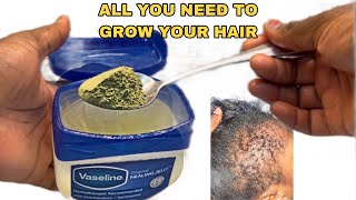 No jokeThis hair growth recipe with VASELINE will be ya last stop 10X ya hair growthApril 5 2024 [upl. by Blanca]