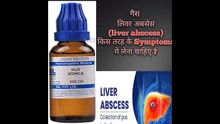 nux vomica use in hindi  nux vomica 200 use  किस तरह के गैस मे इस्तेमाल करना चाहिए [upl. by Maximilien]