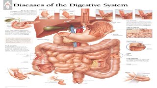 Ultimate Guide to Digestive System Diseases 2024 ibd [upl. by Rovelli]