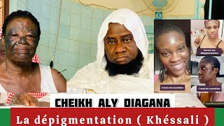 Cheikh Aly Diagana  conséquences de la dépigmentation Khéssali  abonnezvous [upl. by Ah]