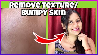 3 Steps to Get Rid Of Bumpy Skin  How to Remove Textured skin  How to Remove BumpySkin on face [upl. by Aldridge]