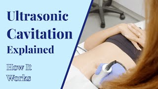 How Does Ultrasonic Cavitation Work  Body Treatments at BYou Laser Clinic in NYC [upl. by Corson712]