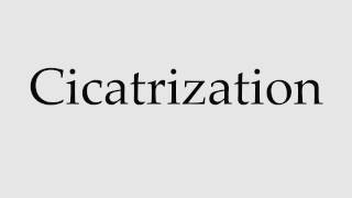 How to Pronounce Cicatrization [upl. by Ethelin]