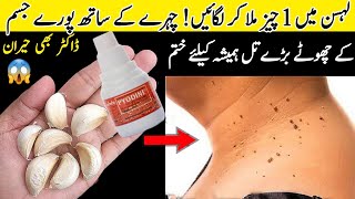 Best Solution to remove moles and warts from the roots  Remove Skin Tag Naturally  Home Remedies [upl. by Schiro]