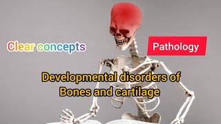 Developmental Disorders of Bone and Cartilage Part I  Pathology  MAT MEDICOS [upl. by Mosa770]