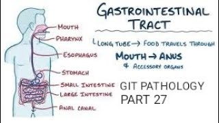 Intestine cystic fibrosis Environment enteropathy amp autoimmune enteropathygit pathology [upl. by Hassi823]