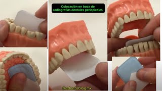 Colocación en boca de radiografías dentales periapicales para toma de radiografías [upl. by Askari210]