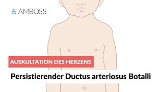 Persistierender Ductus arteriosus Botalli  Auskultation des Herzens  Folge 6 [upl. by Ahsenom248]