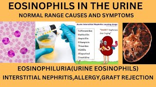 EOSINOPHILS IN URINENORMAL RANGE CAUSES OF EOSINOPHILS IN URINELYMPHOCYTES MONOCYTES IN URINE [upl. by Melmon]