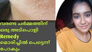 വരണ്ട ചർമം അകറ്റാൻ Get Rid Of Dry Skin Naturally At HomeMalayalam [upl. by Amikan]