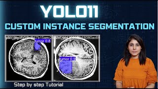 YOLO11 Instance Segmentation on Custom dataset [upl. by Faythe]