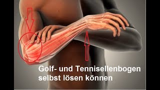 schnelle Selbsthilfe bei Golferarm amp Tennisellenbogen  Epicondylitis [upl. by Freeman426]