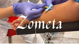 My Second Zometa Infusion Zoledronic acid Breastcancer Treatment Plan HormoneTherapy [upl. by Tumer]