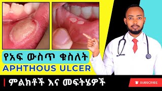 Ethiopia  የአፍ ውስጥ ቁስለት Aphthous ulcer መፍትሄዎች [upl. by Zinah]