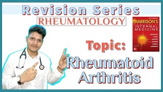 RHEUMATOID ARTHRITIS  Etiopathogenesis  Clinical Features  Diagnosis  Treatment  Harrison [upl. by Brunn]