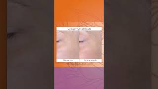 BEAUTY FOCUS COLLAGEN BEFORE AFTER REVIEW collagenplus shorts [upl. by Erihppas]