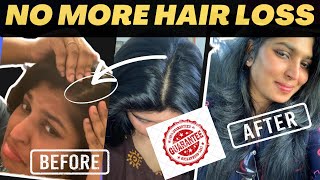 How To Avoid Hair Loss amp Improve Hair Growth  Tamil Weight Loss amp Hair Loss  Sakiye Sathya [upl. by Etnad]