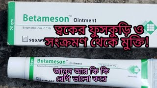 betameson ointment cream  Betameson cream review [upl. by Ly]