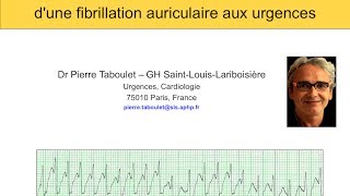 5f Fibrillation atriale Cardioversion aux urgences ECG Atelier pratique Dr Taboulet [upl. by Richara50]