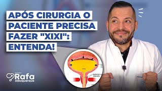 Por que após uma cirurgia o paciente precisa ter a diurese espontânea 🤨 [upl. by Lipps731]