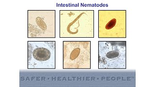 Diagnostic Features of Intestinal Nematodes [upl. by Akinit]