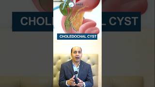 What is Choledochal Cyst  Dr Aditya Kulkarni dradityakulkarni oasisclinic bileductcyst shorts [upl. by Nonek331]