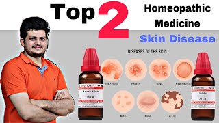 Top 2 Homeopathic Medicine for Skin  चर्म रोग की सबसे बेहतरीन दो होम्योपैथिक दवा [upl. by Atthia21]