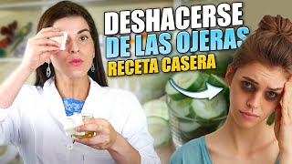 DESHACERSE DE LAS OJERAS  Receta Casera [upl. by Ennaj698]