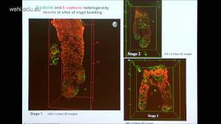 Tan 2014 Wnt Signalling and Colon Cancer a Computational Systems Approach [upl. by Irami519]