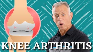 5 Proven Exercises for Knee Osteoarthritis or Knee Pain Do it Yourself [upl. by Mikol815]