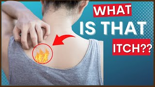 Notalgia Paresthetica “Itchy Back” amp Causes Symptoms amp Tips For Treatment [upl. by Orgalim901]