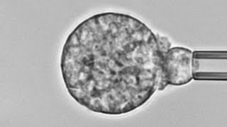 Human neutrophil versus Coccidioides cause of Valley fever Chemotaxis adhesion and phagocytosis [upl. by Oech]