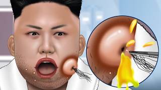 ASMR Facial care for Kim JongUn  Skincare Animation  Removal Ingrown Hair Sebum Shaving [upl. by Idissac]