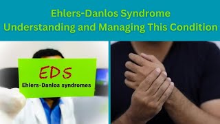 Understanding EhlersDanlos Syndrome Symptoms and Treatments [upl. by Adnamma198]