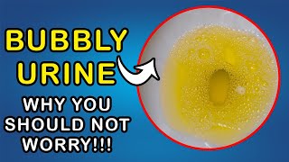 BUBBLES IN URINE Why you dont need to worry [upl. by Ennairrek]