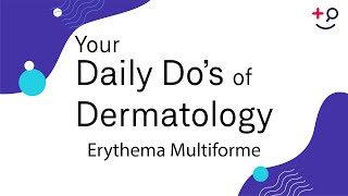 Erythema Multiforme  Daily Dos of Dermatology [upl. by Elli]