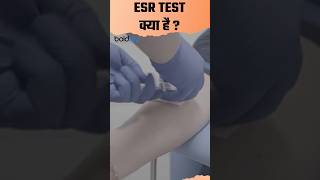 ESR Blood Test Kya Hai esr esrtest bloodtest healthtips healthylifestyle blood [upl. by Adnaval]