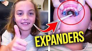 Getting a Palatal ExpanderHow expanders work  McKinney Orthodontist [upl. by Aonian]