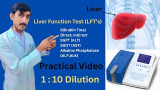 Liver Function Test Procedure in Urdu Hindi  How To Make 110 Dilution  Micro lab 300 [upl. by Mairam]