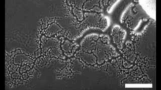 Mehrana Nejad Activityinduced interfacial pattern in bacterial droplet [upl. by Sajovich35]