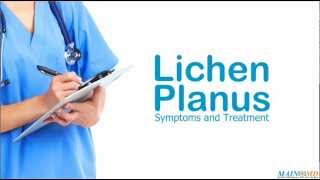 Lichen Planus Symptoms and Treatment [upl. by Kelvin]