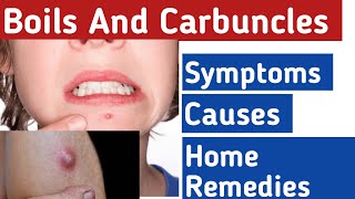 Boils and Carbuncles What causes boils on your body Boils on body home treatment [upl. by Neggem]