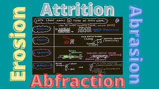 Attrition🟡Erosion🔵Abrasion🔴Abfraction [upl. by Haeckel]