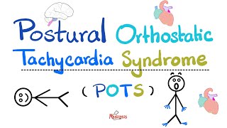 Postural Orthostatic Tachycardia Syndrome POTS  Causes Symptoms Diagnosis TreatmentCardiology [upl. by Malinda]