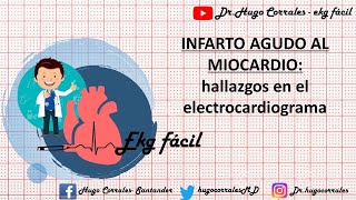 INFARTO AGUDO DE MIOCARDIO Hallazgos electrocardiográficos [upl. by Hyps]