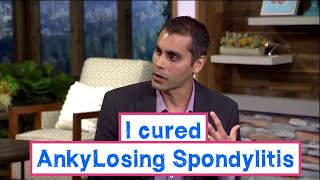 I cured my Ankylosing Spondylitis [upl. by Dex]